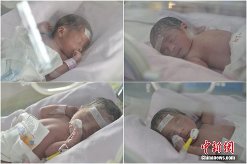 A woman born in the 1980s has given birth to four identical baby girls in Taiyuan, north China's Shanxi province, on Friday. The babies' vital signs are stable. It's said that only one woman among 7.29 million could have quadruplets. [Photo: Chinanews.com]