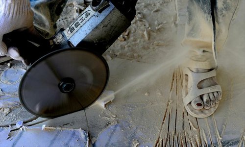 A worker's toes show the effects of long-term dust exposure in Fujian. Photo: CFP