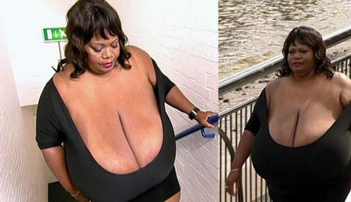 Annie Hawkins - the woman with the biggest natural breasts in the