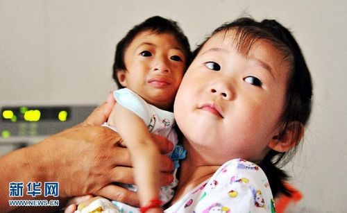 A 3-year-old girl (R) holds Xiaoxiao, the same age as her, in her arms in Changsha, Central China's Hunan Province on July 13. Xiaoxiao is 54 centimeters tall and weighs only 2.6 kilograms. Photo: Xinhua