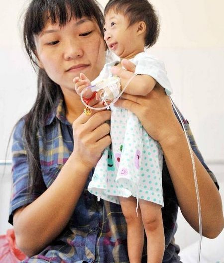 Xiaoxiao, a 3-year-old girl, stands on her mother's legs in Changsha, Central China's Hunan Province on July 13. The tiny girl is 54 centimeters tall and weighs only 2.6 kilograms. Photo: Xinhua