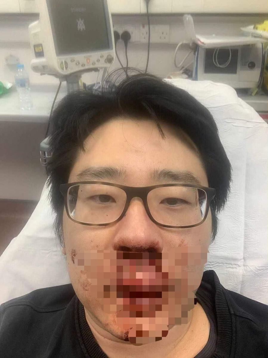 Racist Attack Against Chinese Lecturer At Uk University Arouses Safety Concerns Global Times