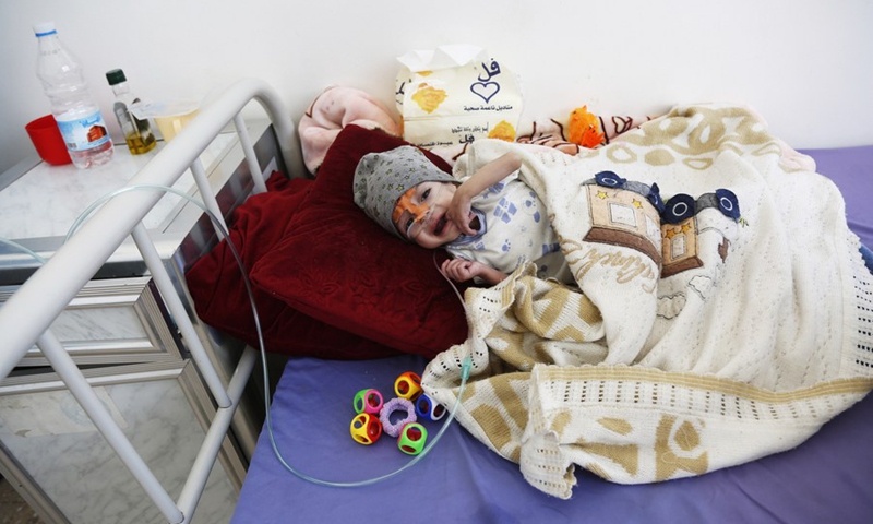 A malnourished Yemeni child receives medical treatment at a hospital in Sanaa, Yemen, on Feb. 27, 2023.(Photo: Xinhua)