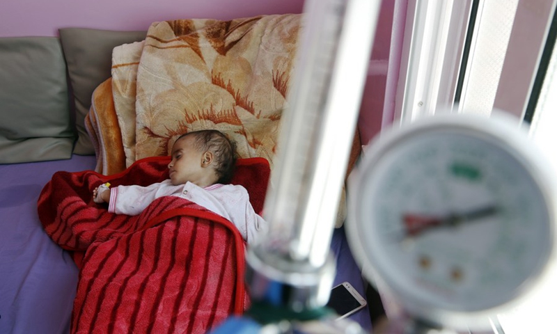 A malnourished Yemeni child receive medical treatment at a hospital in Sanaa, Yemen, on Feb. 27, 2023.(Photo: Xinhua)