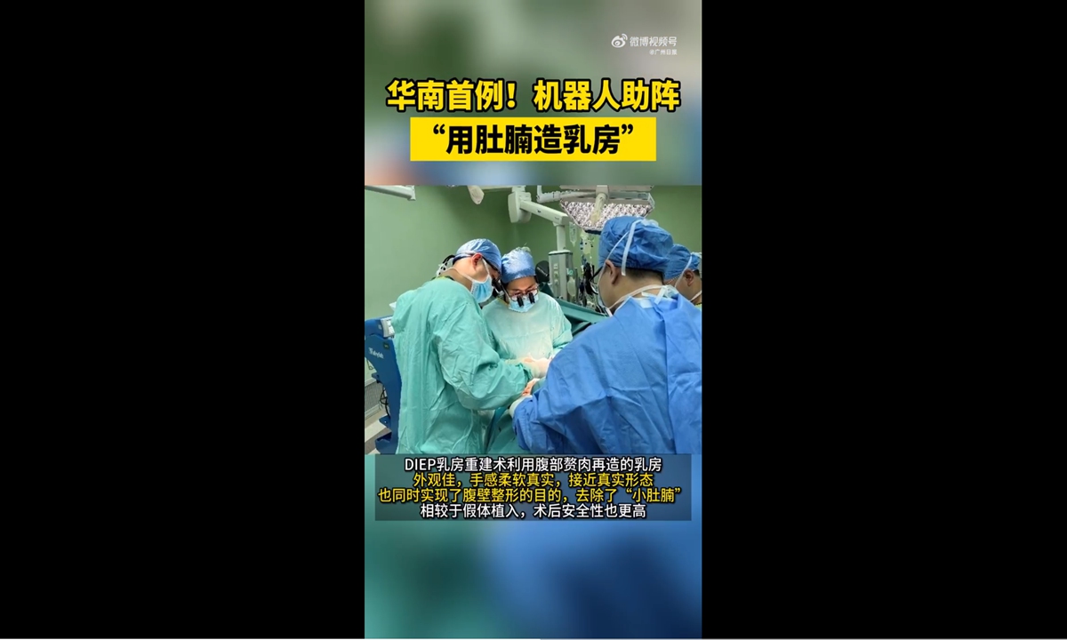 Doctors use patient's belly to reconstruct breast in Guangzhou Photo: screenshot from Guangzhou Daily