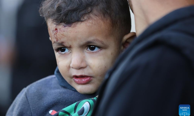 A wounded child is pictured at a hospital in central Gaza Strip city of Deir el-Balah, Dec. 3, 2023. (Photo: Xinhua)