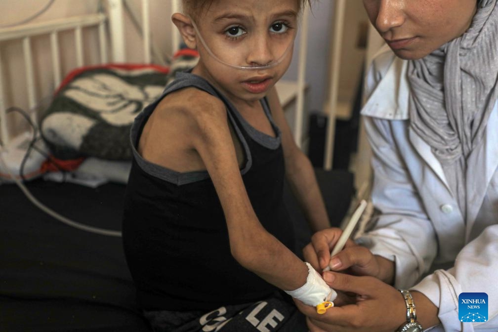 A child patient receives treatment at Nasser Hospital in the southern Gaza Strip city of Khan Younis, Aug. 19, 2024. (Photo: Xinhua)