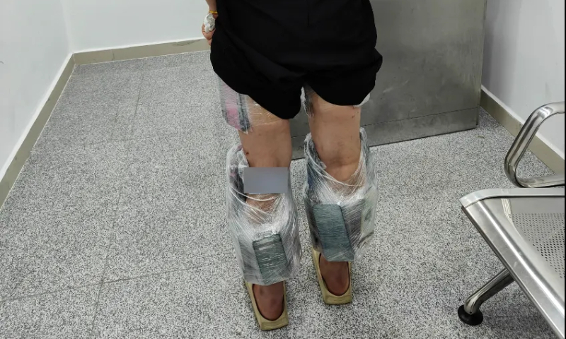 A woman with a total of 74 mobile phones tied to her legs entered the country via the Gongbei Port and was seized on the spot by customs officers under Gongbei Customs. Photo: China’s General Administration of Customs