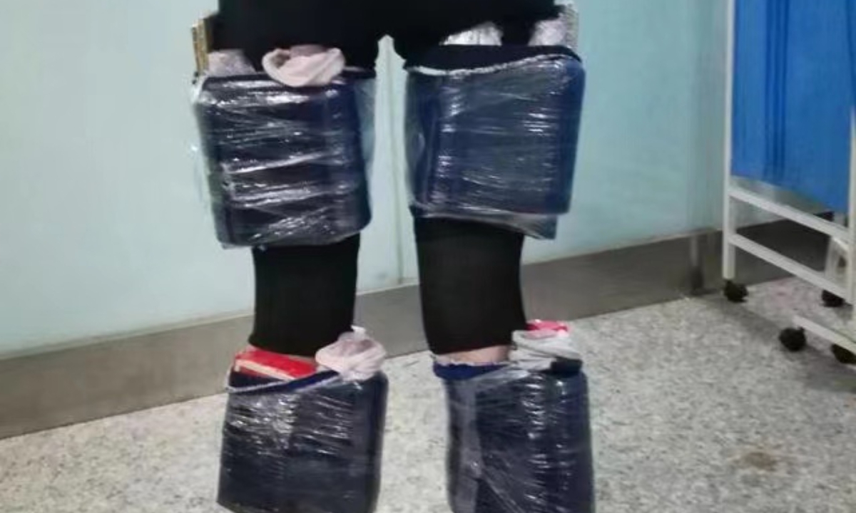 Woman caught smuggling 6 bottles of Moutai liquor strapped to two legs: customs