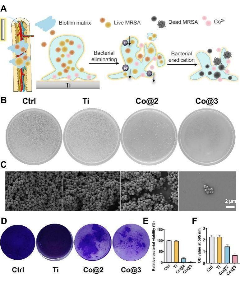 Chinese researchers have achieved a major breakthrough in orthopedic treatment with a new implant material designed to accelerate bone healing and minimize infections. Photo: Science and Technology Daily