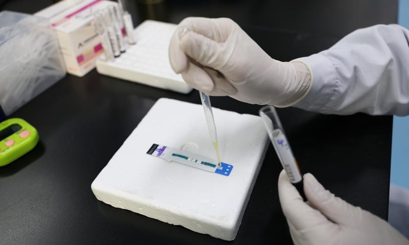 A doctor tests a sample for HIV/AIDS infection at the Fourth People's Hospital of Nanning, in Nanning, south China's Guangxi Zhuang Autonomous Region, Nov. 21, 2024. (Photo: Xinhua)