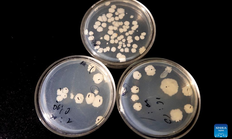 This photo taken on Dec. 6, 2024 shows microorganisms selected by the team of Yang Guoping to transform saline-alkali land at a laboratory in northwest China's Ningxia Hui Autonomous Region. In recent years, the team of Yang Guoping, a professor of North Minzu University, has been committed to the study of using microorganisms to transform saline-alkali land into arable land. Photo: Xinhua