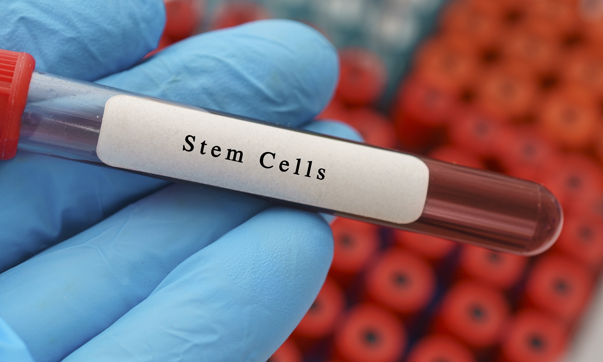 Stem cell sample Photo: VCG